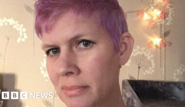 Bedfordshire woman with ME criticises health plan for condition