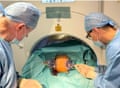 Surgeons operating on a patient’s shaved head.