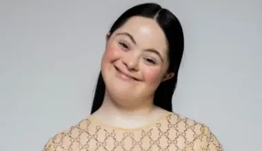 Japanese Scientists Discover a Way to Treat Down Syndrome