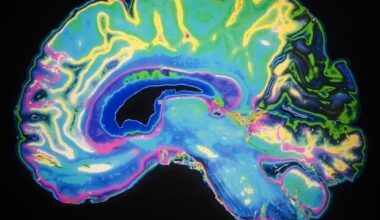 Middle precentral gyrus plays key role in orchestrating speech movements