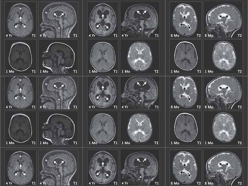 Emma’s Gene - Life Sciences | Weizmann Wonder Wander