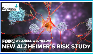 Study explores genetics and lifestyle in Alzheimer's risk