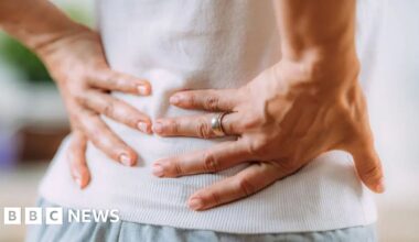 AI app halves wait time for back pain physio in Cambridgeshire