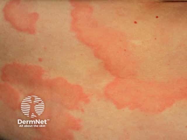 Genetic Links Strengthen CSU Understanding