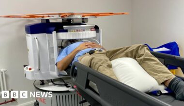 New brain scanner trialled in Kent could speed up dementia diagnosis