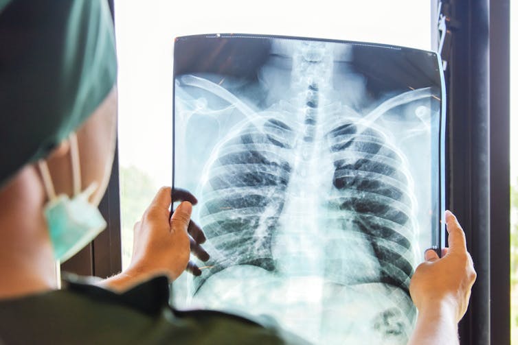 A doctor examining lung X-rays.