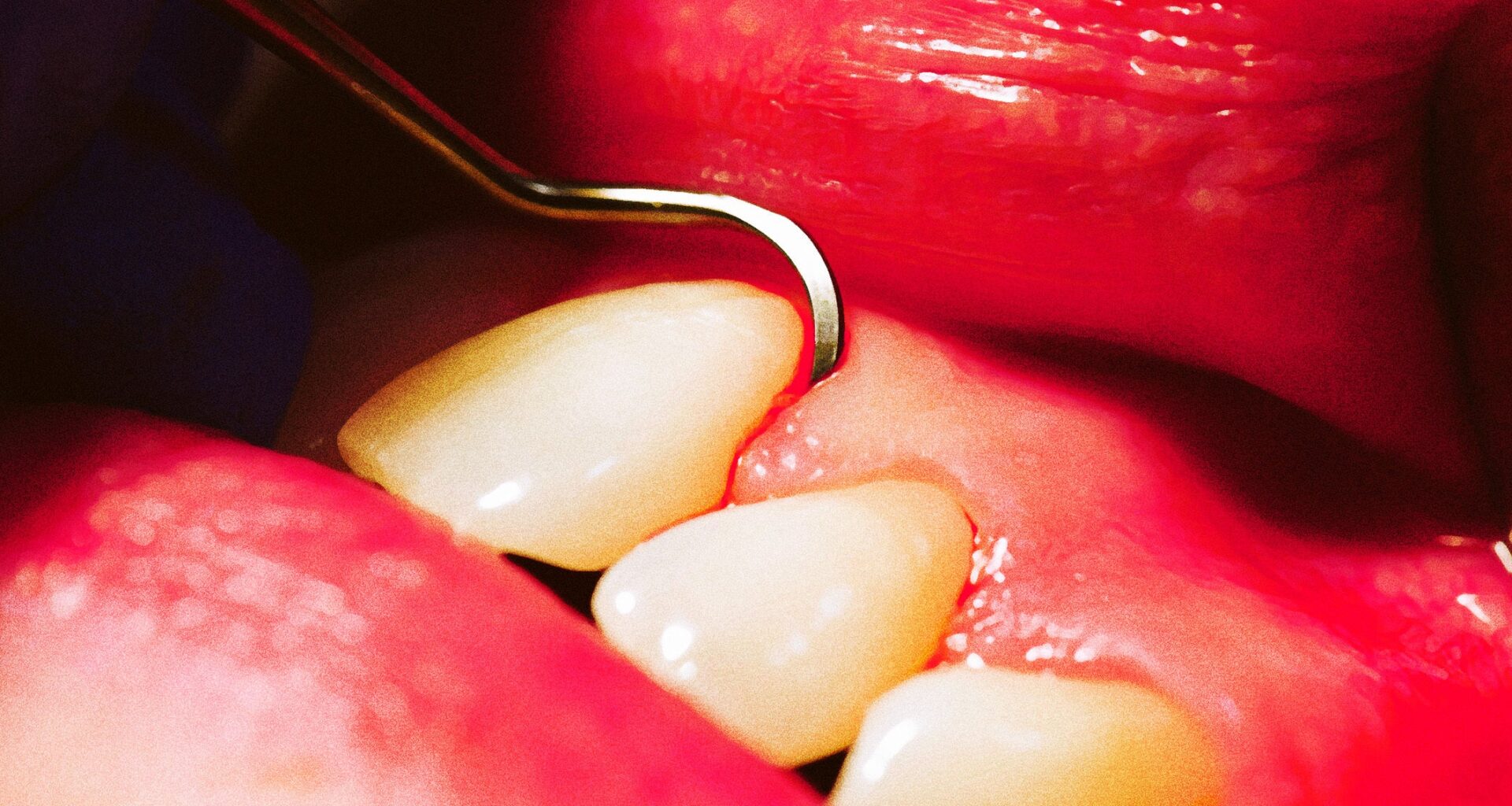 Private Equity Is Destroying Our Teeth, Dental Professionals Warn