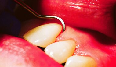 Private Equity Is Destroying Our Teeth, Dental Professionals Warn