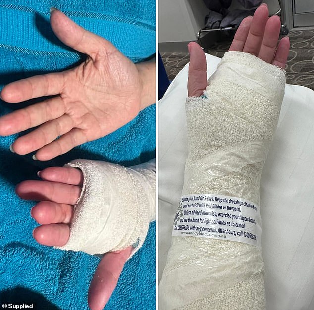 Elton had helped Ms Elder keep moving and stay positive following surgery on her hands (pictured) two years ago