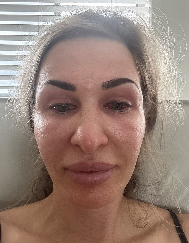 Loz was battling crippling fatigue and weight gain, despite a diligent exercise routine and healthy diet