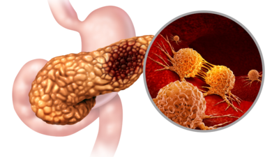 Is vitamin B12 crucial to pancreatic health? Here's why doctors say yes