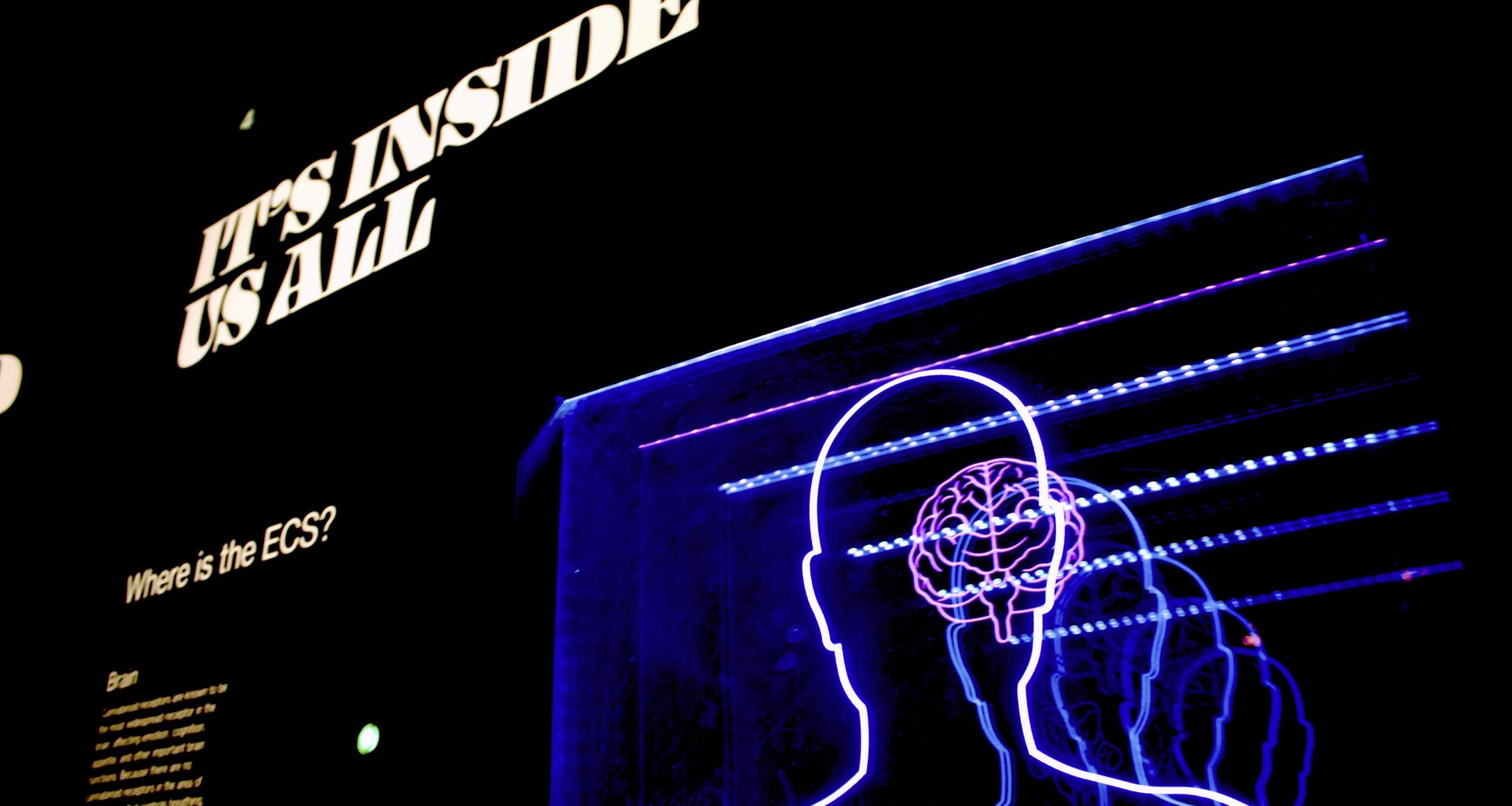 Brain Eyed for New Type 1 Diabetes Treatments