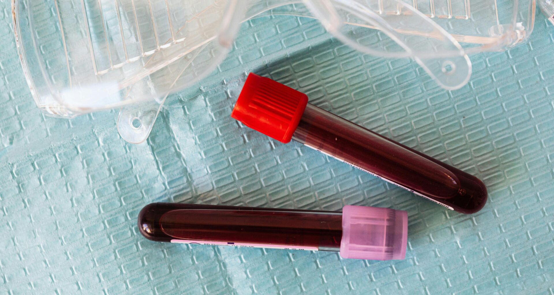 Prediabetes more life-threatening for people aged 20–54, study finds