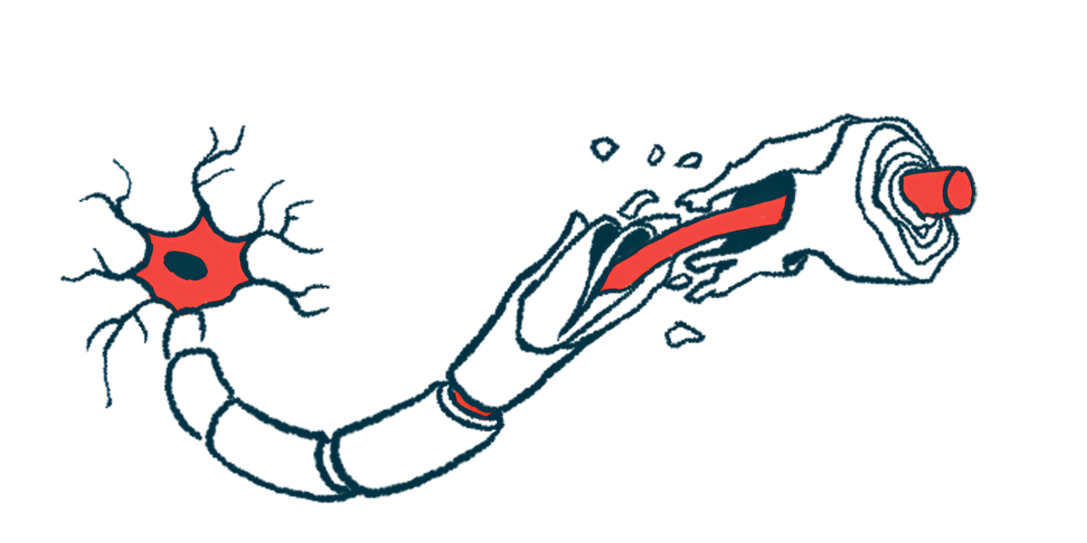 An illustration shows damage to the myelin sheath that protects nerve fibers.