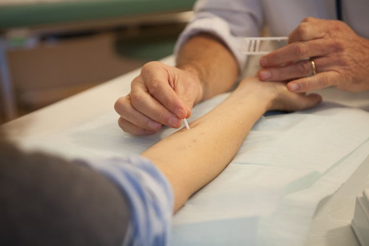 An arm stretched out on an examining table gets pricked with a white needle by the hands of a clinician administering an allergy test.