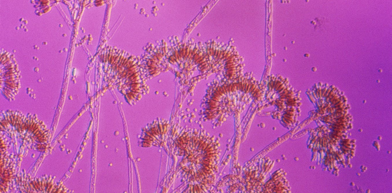 Are you really allergic to penicillin? A pharmacist explains why there’s a good chance you’re not − and how you can find out for sure