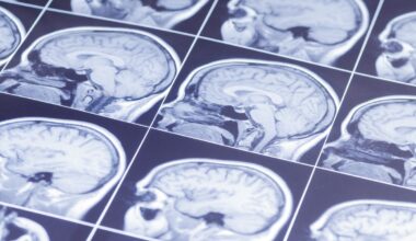 Man With 31-Year History Of Depression Feels “Overwhelming Joy” After Experimental Brain Stimulation