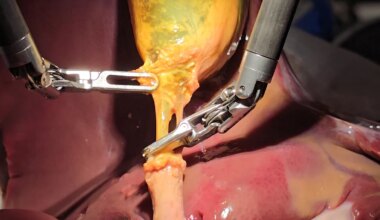 When AI surgeons step into the operating room