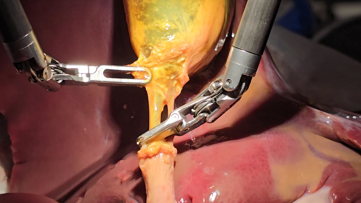 When AI surgeons step into the operating room