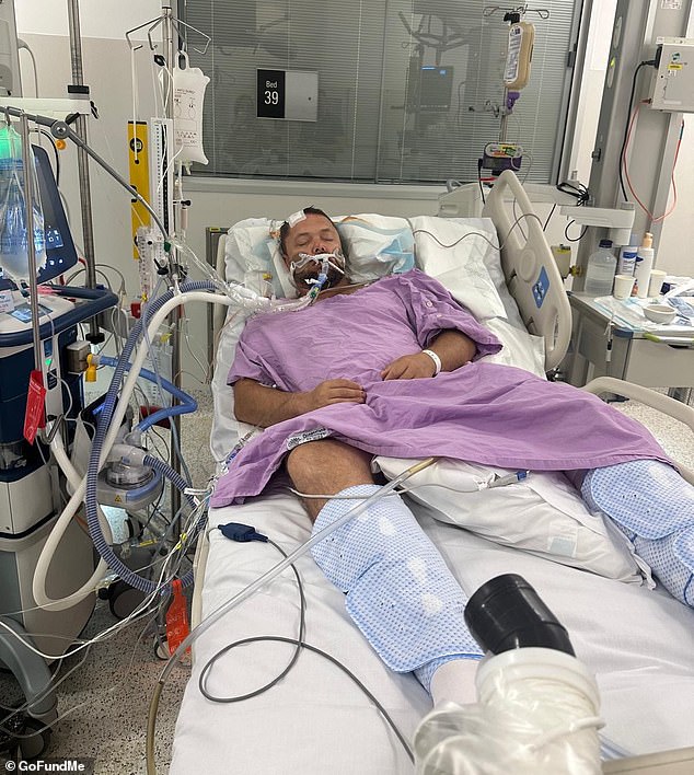 A scan later revealed Franco (pictured in intensive care) had suffered a ruptured subarachnoid brain aneurysm, which is considered by doctors as the 'most severe kind'