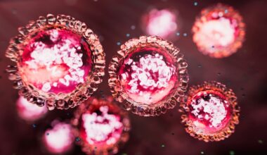 Measles confirmed on Northern Beaches