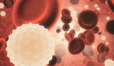 New research highlights gender disparities in sepsis treatment