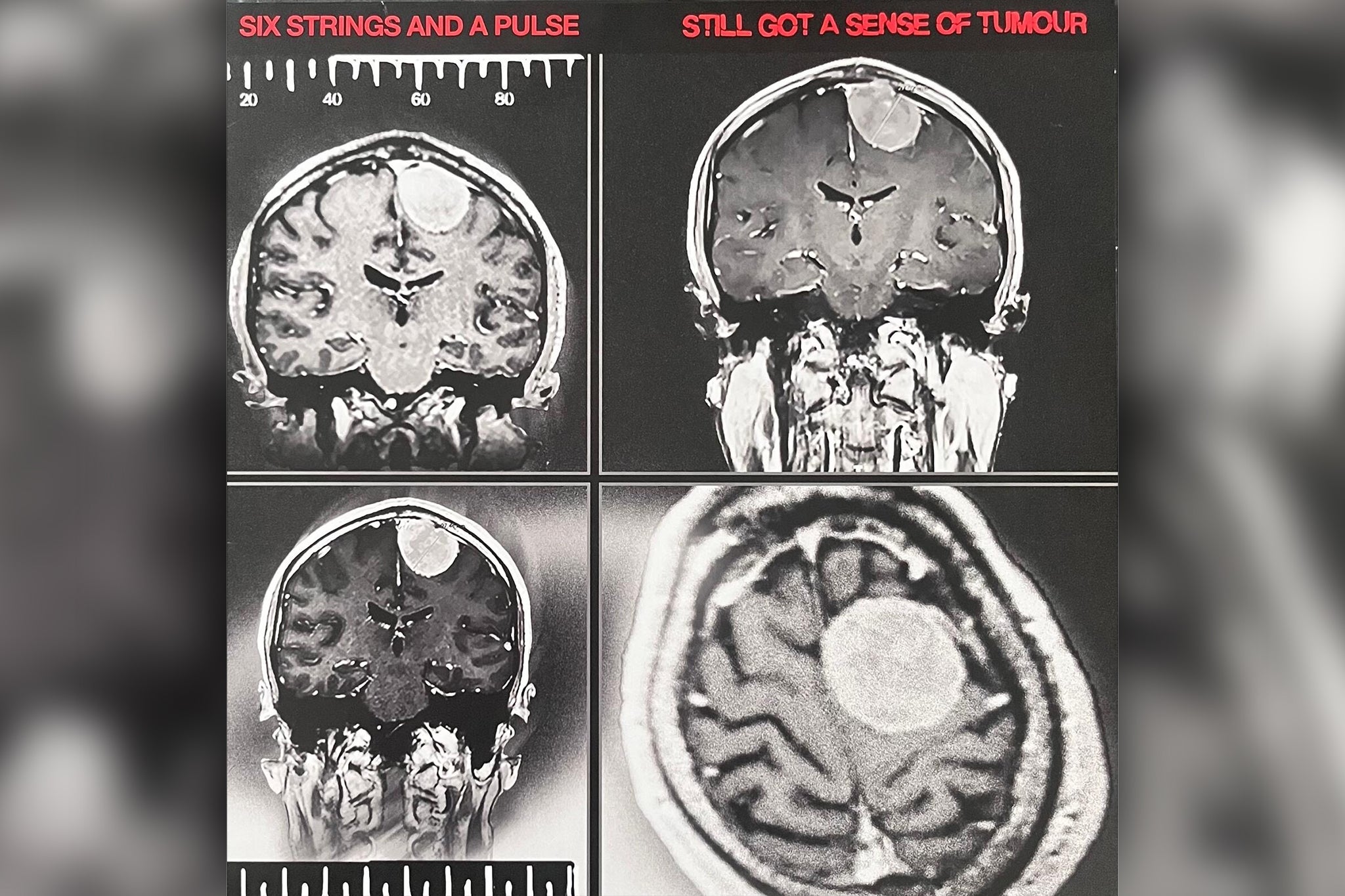 David wrote a modern blues album, ‘Still Got a Sense of Tumour’, to raise money for the charity Brain Tumour Research