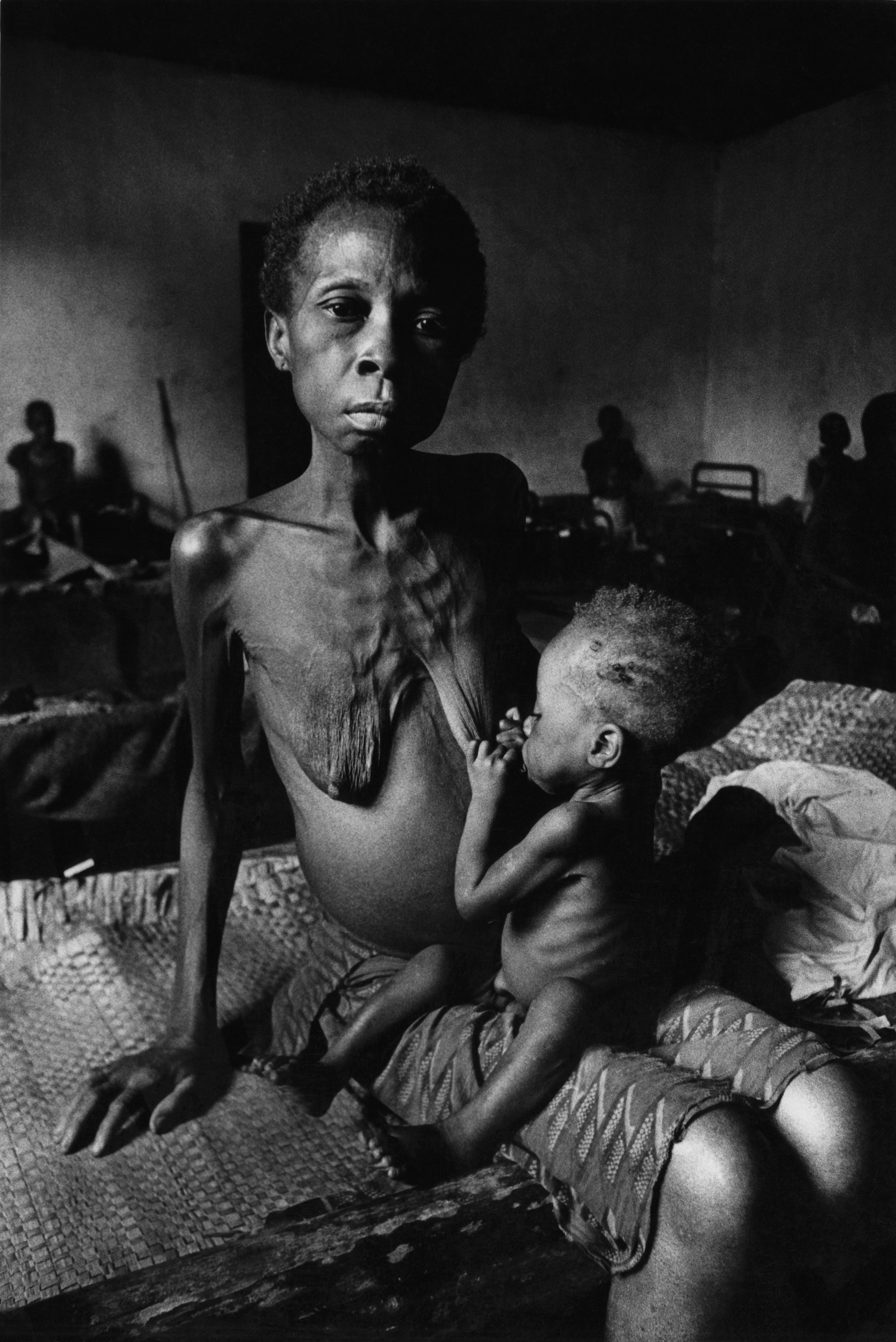 Black and white photo of an emaciated young mother breastfeeding her infant.