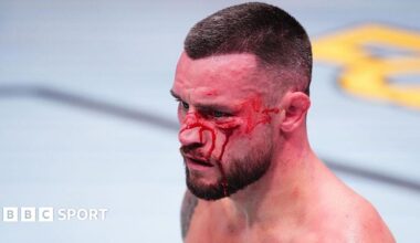 Kiefer Crosbie pictured bleeding in a fight