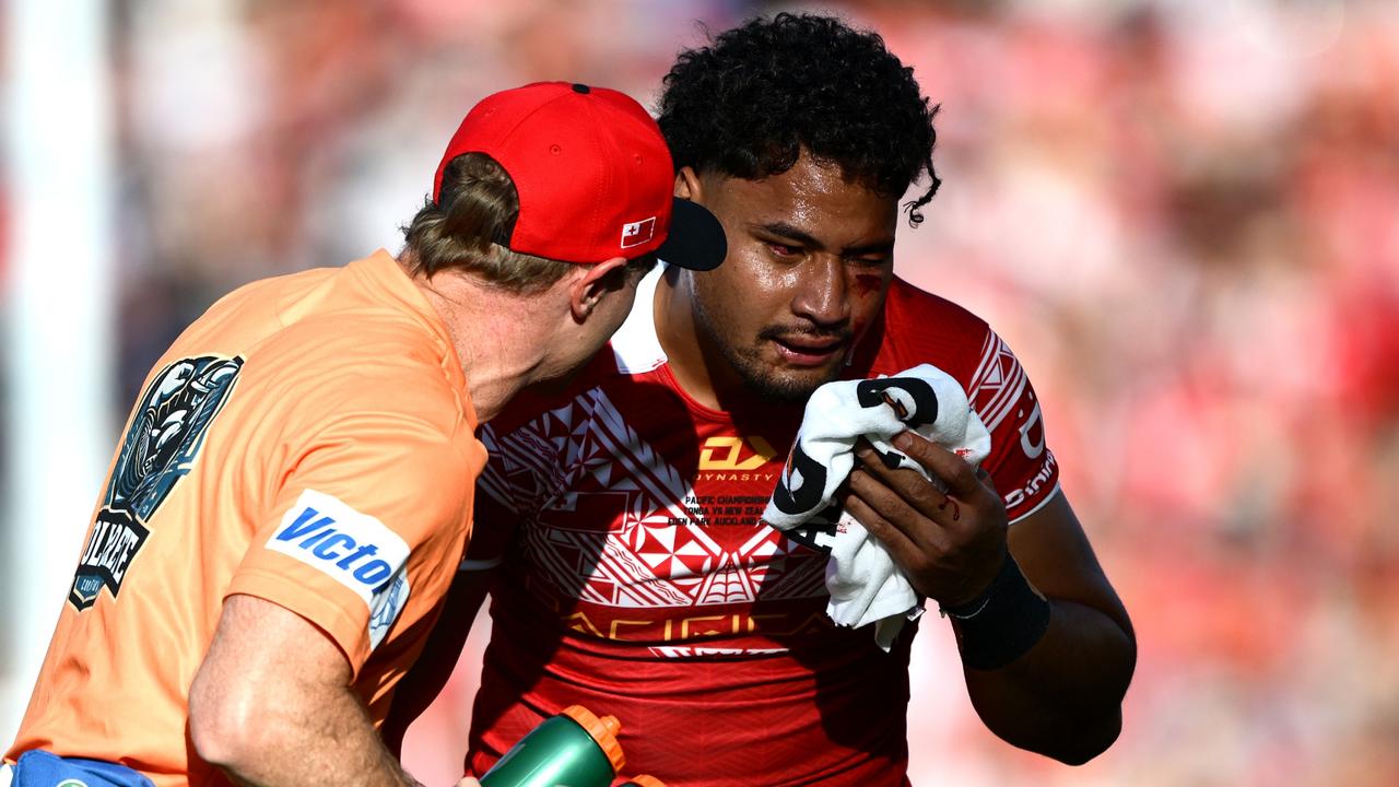 Eliesa Katoa ruled out for 2026 season, Melbourne Storm, Tonga, head knocks, brain surgery, confirmed, news, videos, highlights