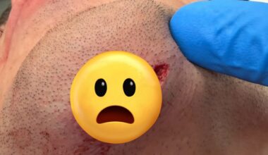 Ricky Simon Suffers Brutal Chin Cut At UFC Vegas 111