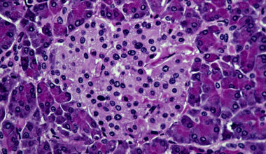 Type 1 Diabetes Cured in Mice Given Experimental Hybrid Treatment : ScienceAlert