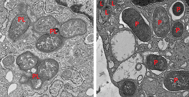 Macrophage activity in the gut