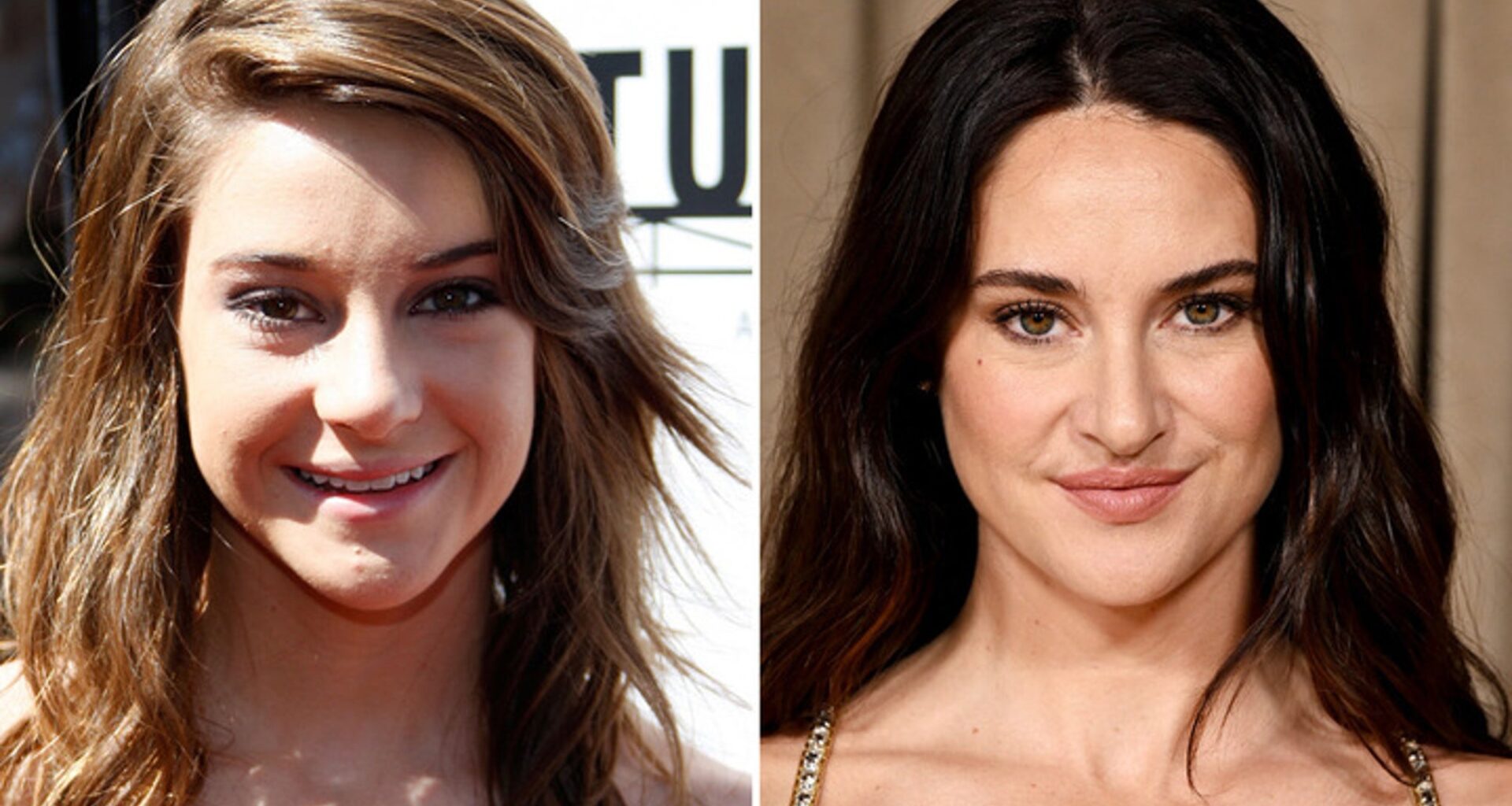 Shailene Woodley -- Good Genes or Good Docs?!