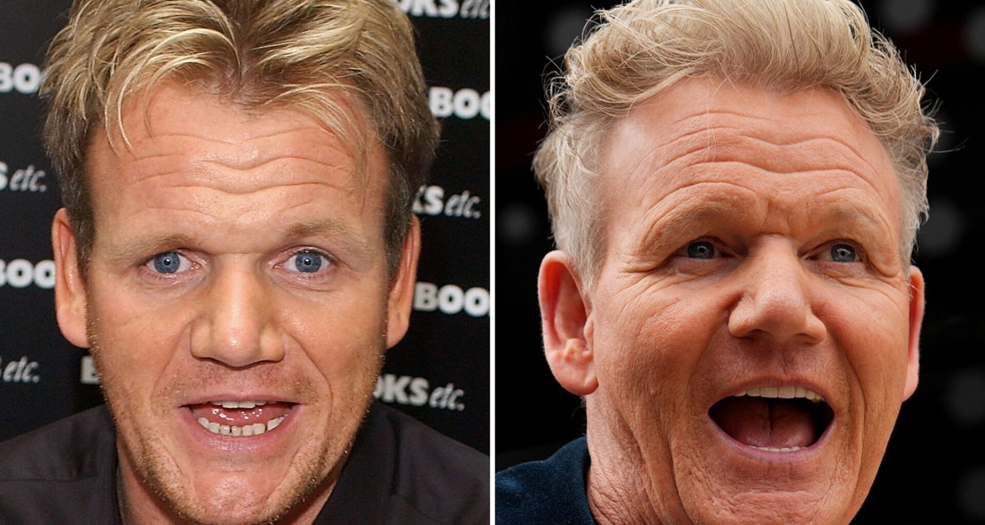 Gordon Ramsay Good Genes or Good Docs?!