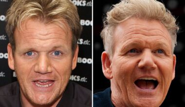 Gordon Ramsay Good Genes or Good Docs?!