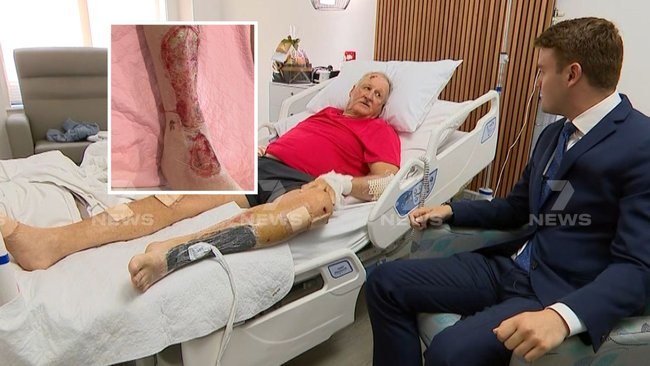 Findlay suffered sickening injuries after he was run over.