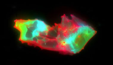 Strange Structures Found Lurking in The Blood of People With Long COVID : ScienceAlert