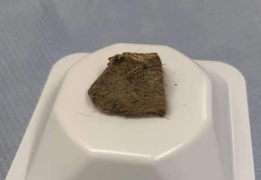 Tissue Of Woolly Rhino