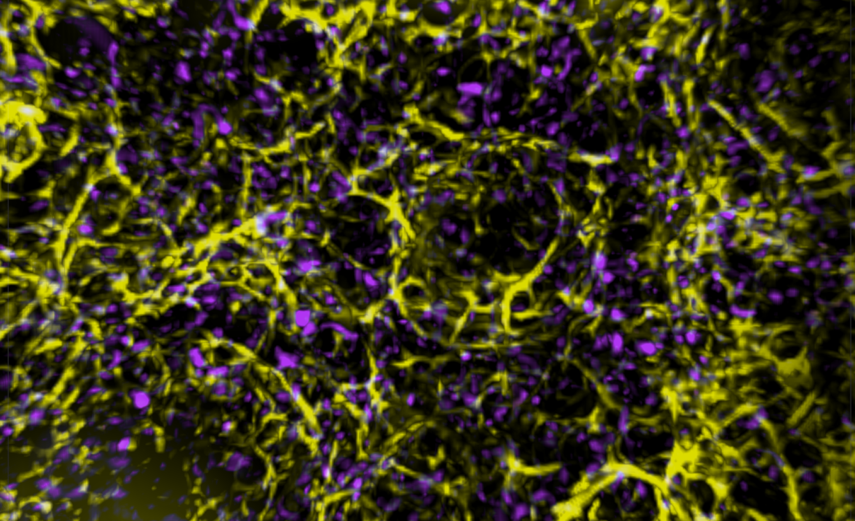 Cell death discovery could aid cancer treatments , News, La Trobe University