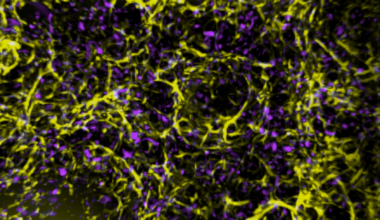 Cell death discovery could aid cancer treatments , News, La Trobe University