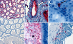 Detection of Lassa virus (LASV) antigens and RNA in reproductive tissues by immunohistochemistry (IHC) and in situ hybridization (ISH) in strain 13/N male guinea pigs lethally infected with LASV strain Josiah in study of guinea pig model for LASV infection of reproductive tract and considerations for sexual and vertical transmission. A) Epididymis (18 dpi), ISH. Regionally extensive staining in epididymal epithelial cells. B) Epididymis (26 dpi), ISH. Staining in interstitial mesenchymal cells, endothelium (arrow), tubular epithelium (white arrow), and intratubular inflammatory cells (asterisk). C) Testis (18 dpi), ISH. Focal intracellular staining in the interstitium (arrow). D) Epididymis (23 dpi), ISH. Intraluminal staining including spermatozoa (asterisk). E) Seminal vesicle (17 dpi), ISH. Focal staining in subepithelial stromal cells. Original magnifications ×5 (panel A), ×40 (panels B, D), ×63 (panel C), ×20 (panel E).