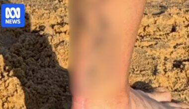 Police overseeing Bondi terror response investigate tattooed man at Newcastle beach