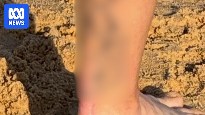 Police overseeing Bondi terror response investigate tattooed man at Newcastle beach