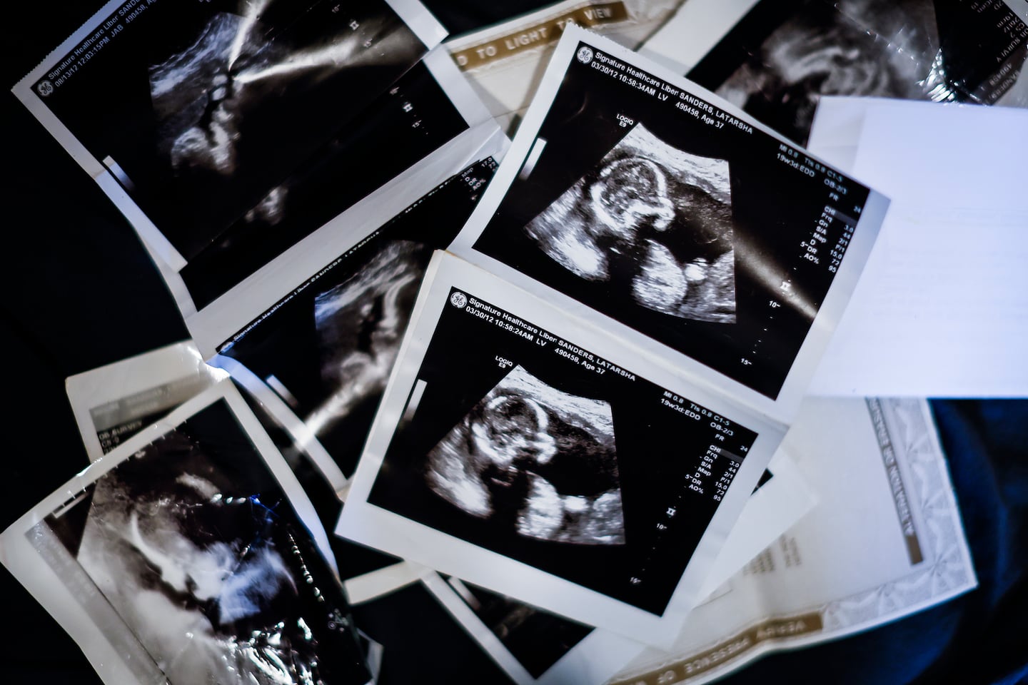 Ultrasound images from her last pregnancy were among the papers in a purse Sanders always carried.
