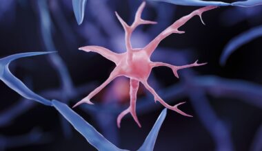 Brain Immune Cells May Drive More Damage in Females than Males with Alzheimer’s