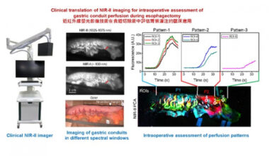 Figure 1. Left: Photograph of NIR-II fluorescence imager (AlbertSurgicalTM). Middle: Imaging of gastric conduits in different spectral windows. Right: Intraoperative principal component analysis (PCA) of the NIR-II video revealed distinct perfusion patterns in the gastric conduit. Image modified from Wang et al, PNAS (2025).