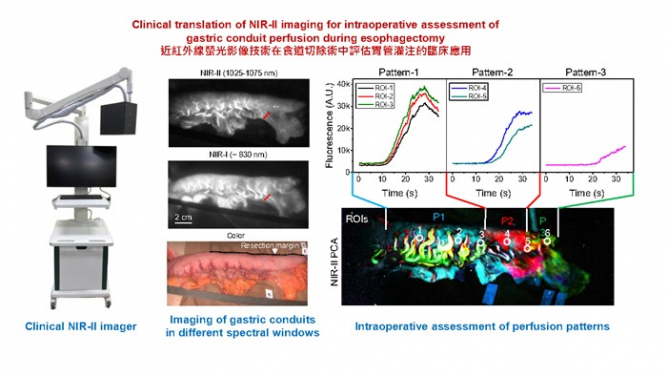 Figure 1. Left: Photograph of NIR-II fluorescence imager (AlbertSurgicalTM). Middle: Imaging of gastric conduits in different spectral windows. Right: Intraoperative principal component analysis (PCA) of the NIR-II video revealed distinct perfusion patterns in the gastric conduit. Image modified from Wang et al, PNAS (2025).