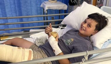 Family praise Royal Flying Doctors Service one year after Gus McPherson, 10, breaks leg in motorbike crash