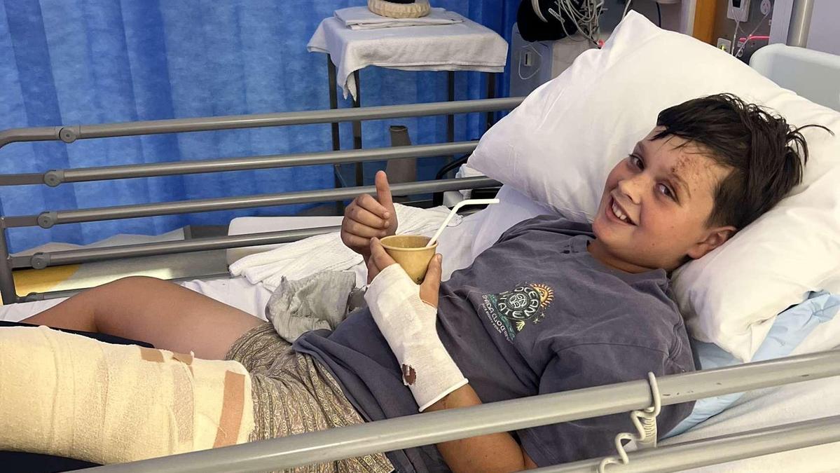 Family praise Royal Flying Doctors Service one year after Gus McPherson, 10, breaks leg in motorbike crash